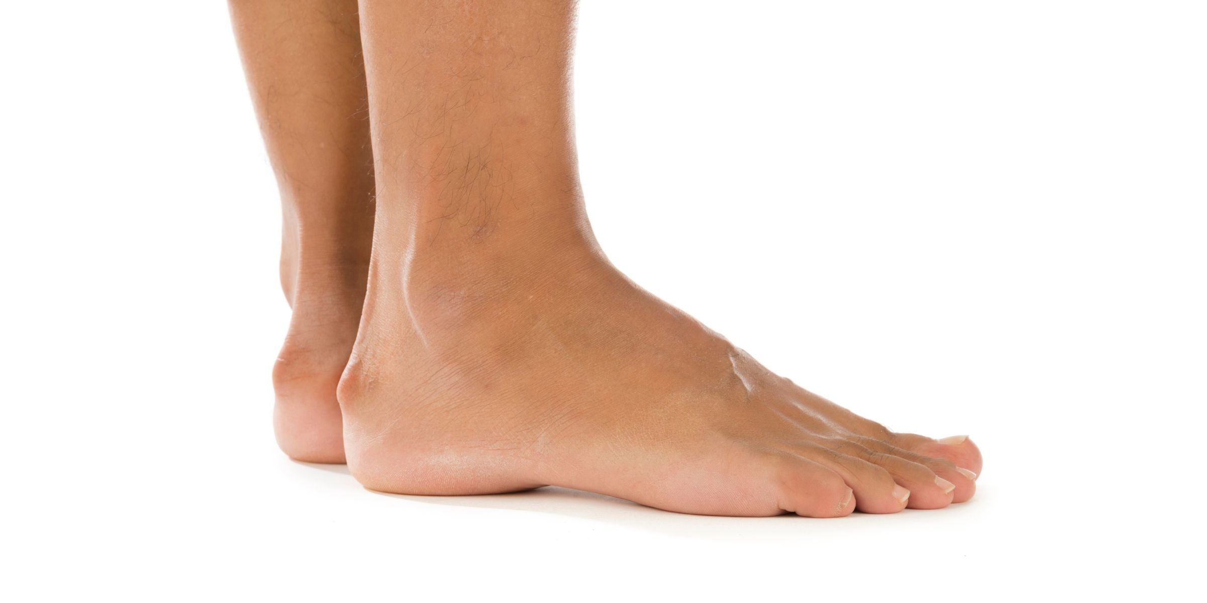 Haglundferse behandeln