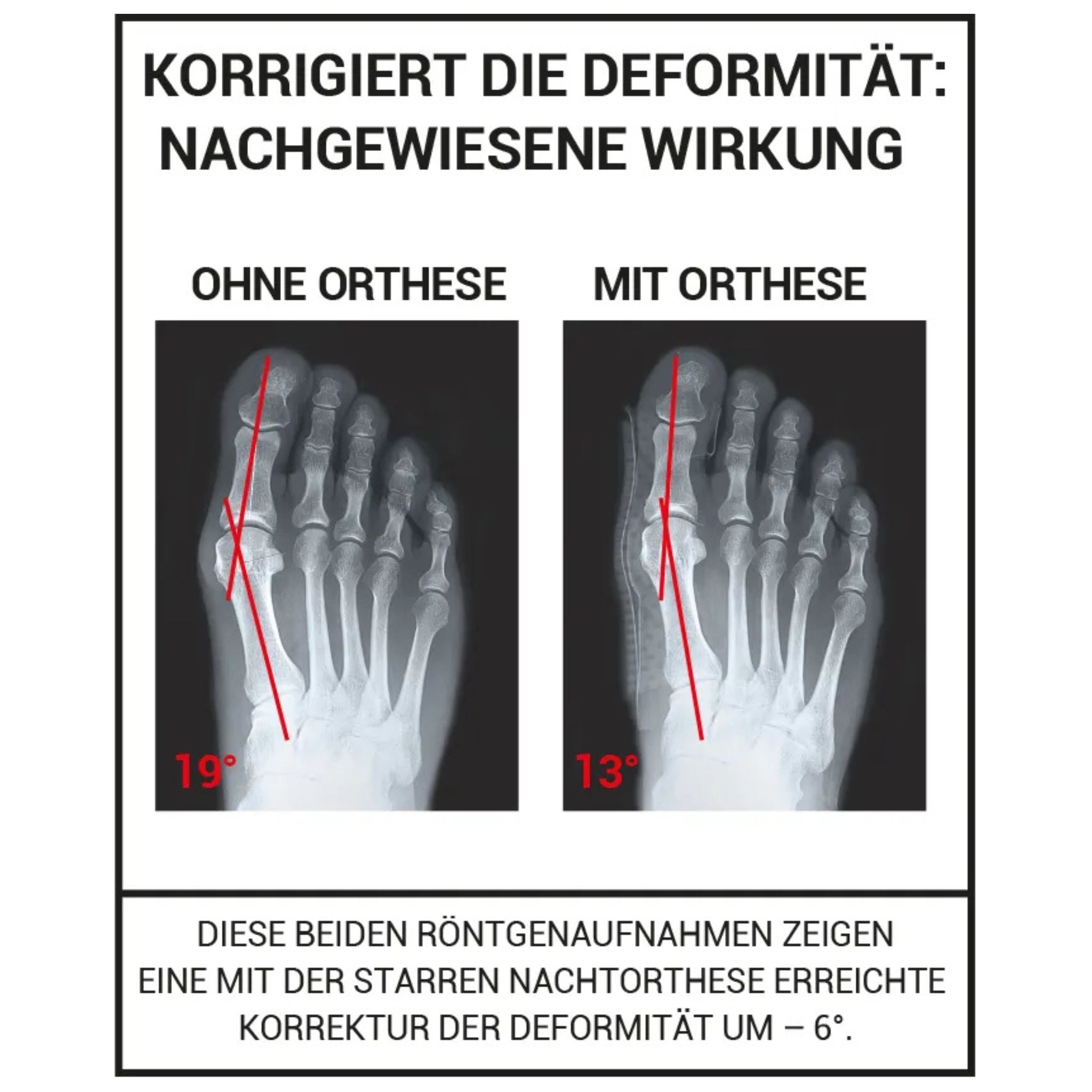Detailliertes Bild der Wirkweise