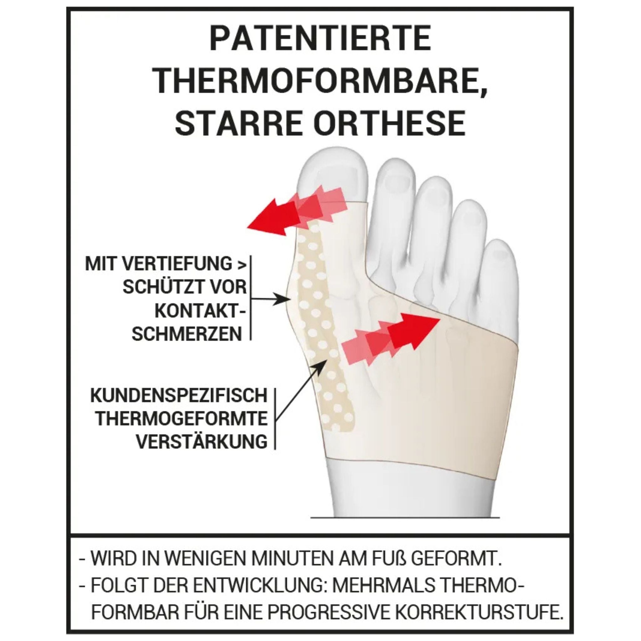 Erklärung der Wirkweise bei Hallux Valgus