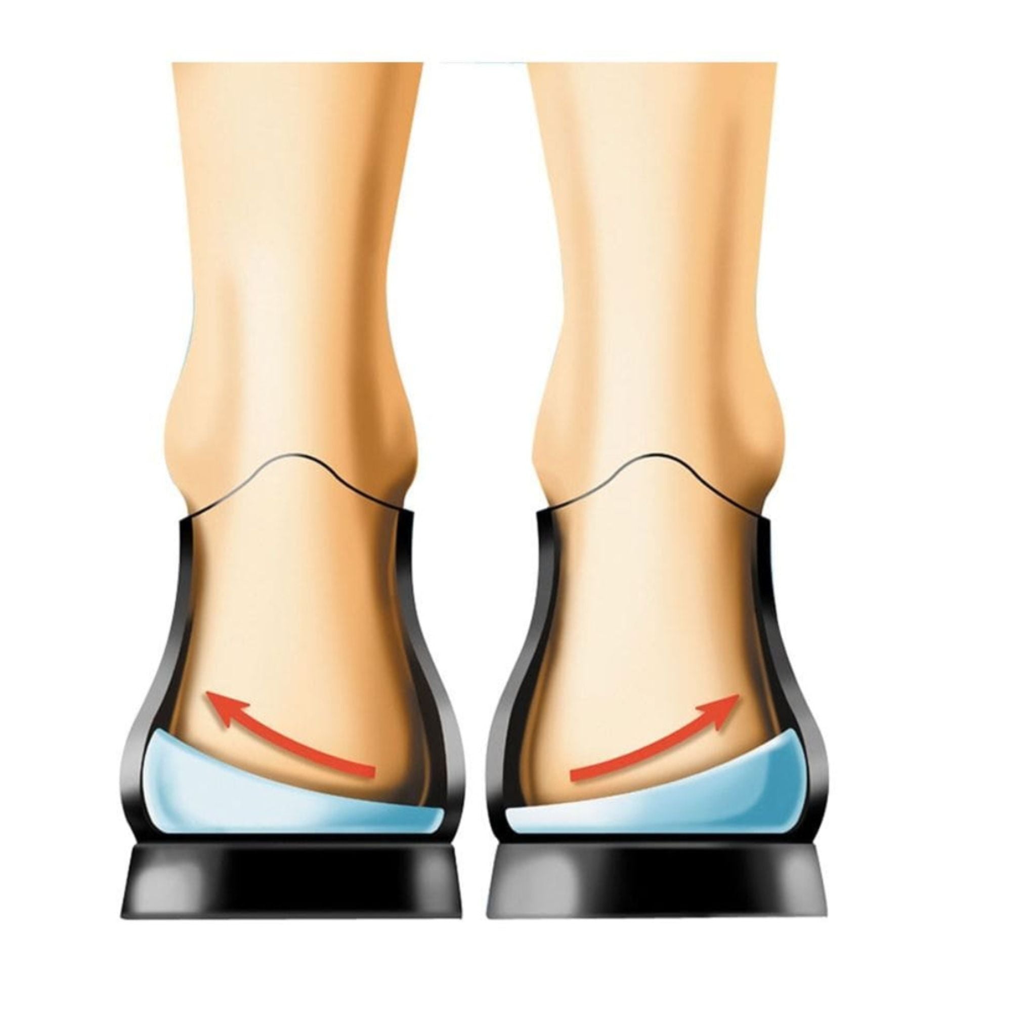 Korrektur von O-Beinen