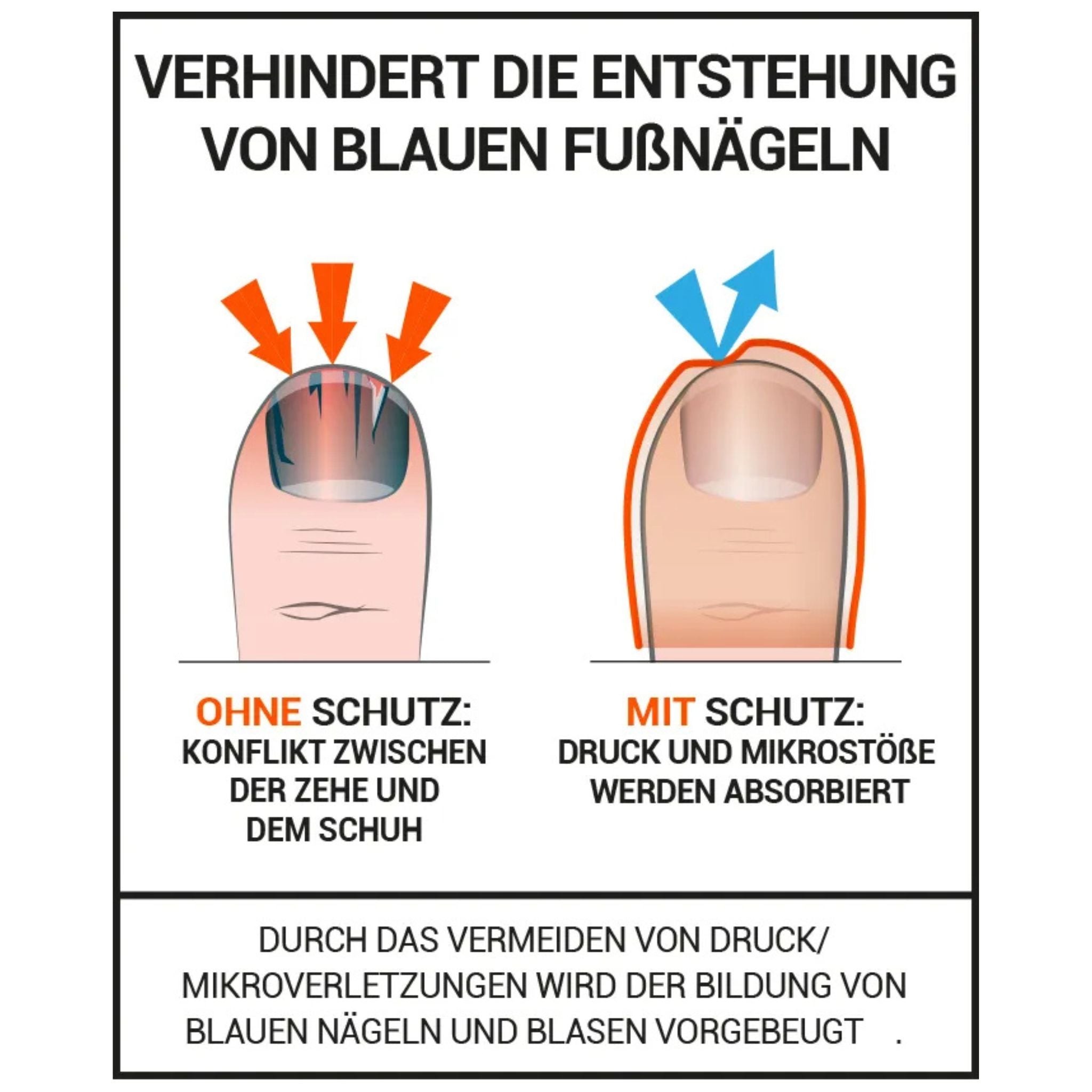 Zehenpolsterung gegen blaue Nägel