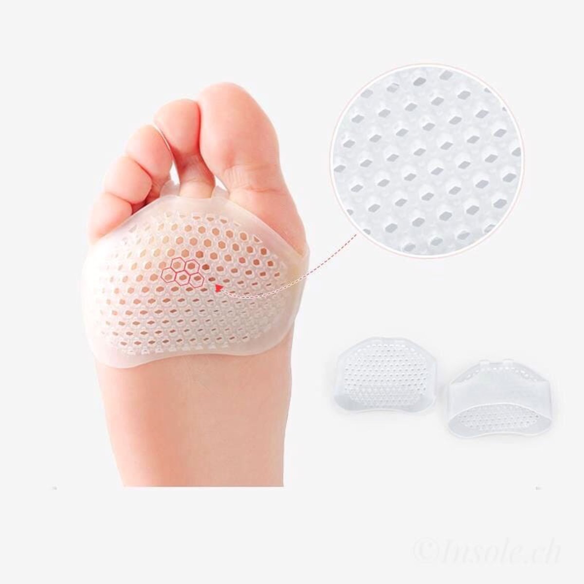 Morton Neuralgie Mittelfuss Schmerzen