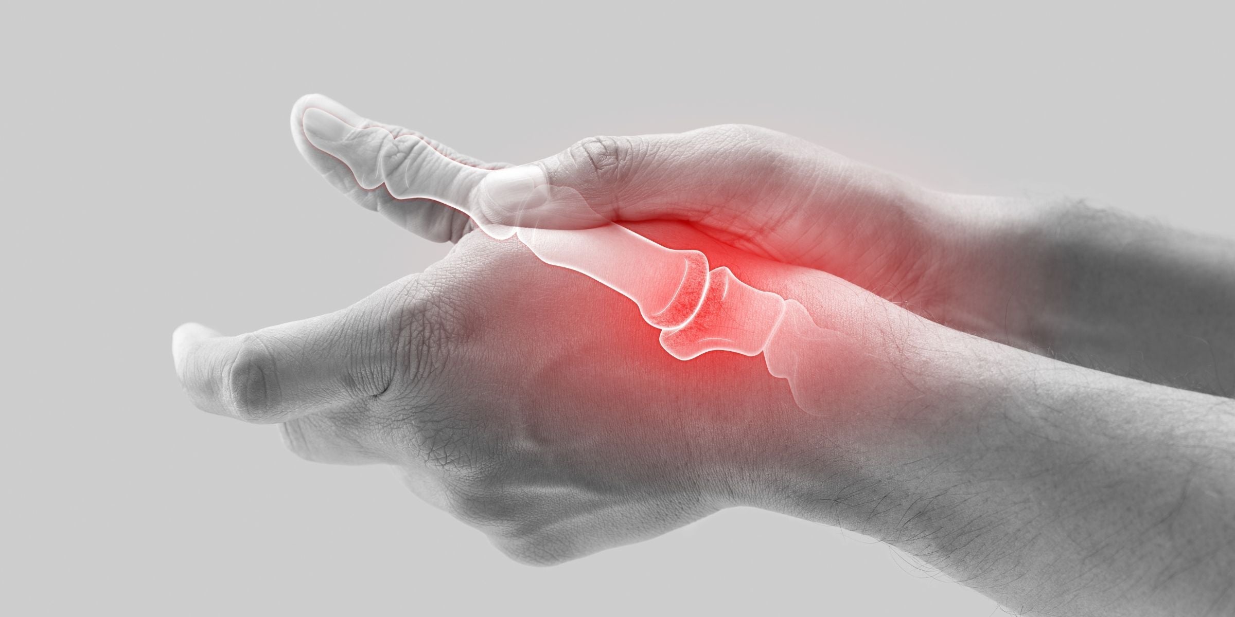 Daumensattelgelenksarthrose Behandlung