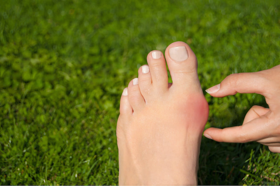 Hallux Valgus Ballenzeh Symptome