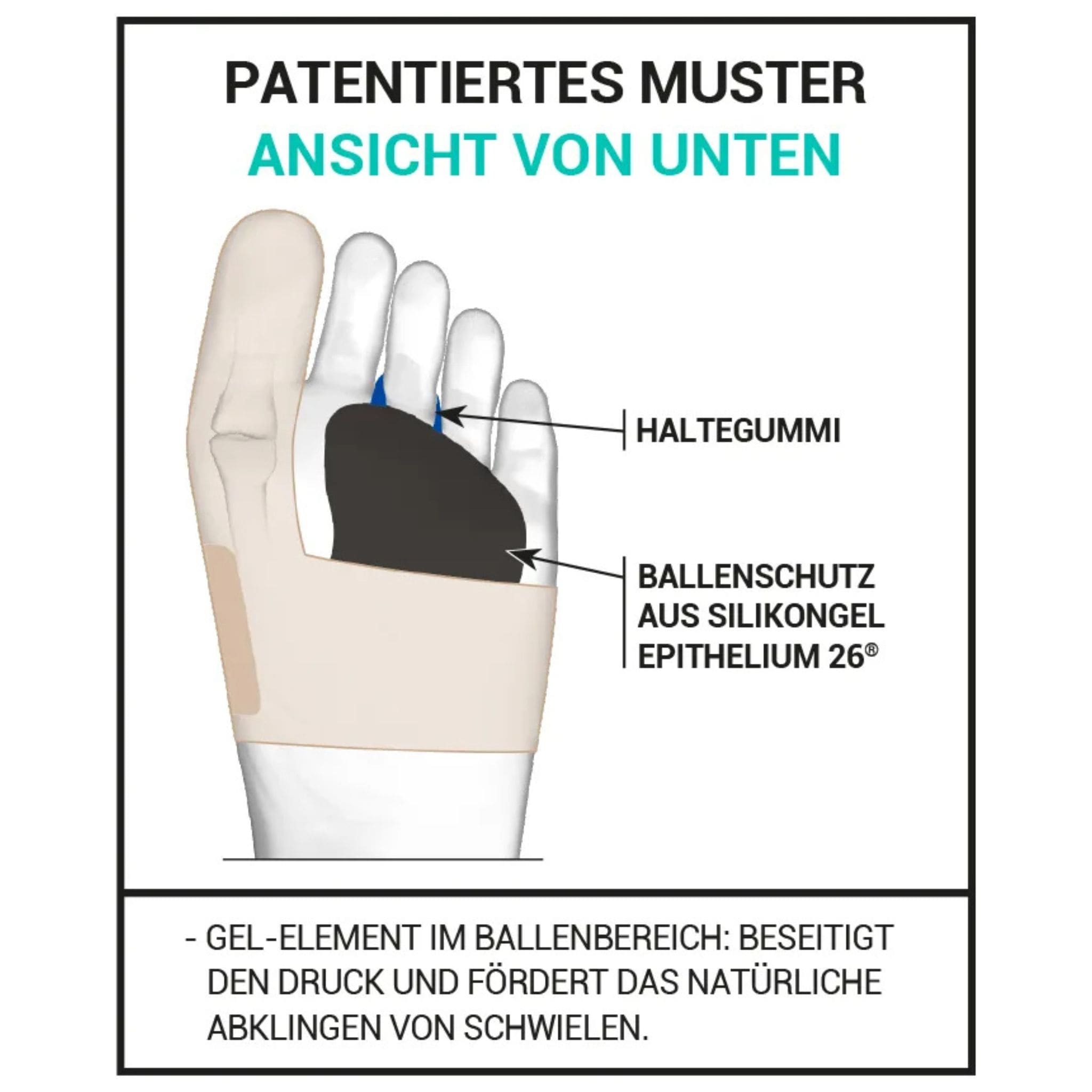 Aufbau der Korrekturbandage Erklärung