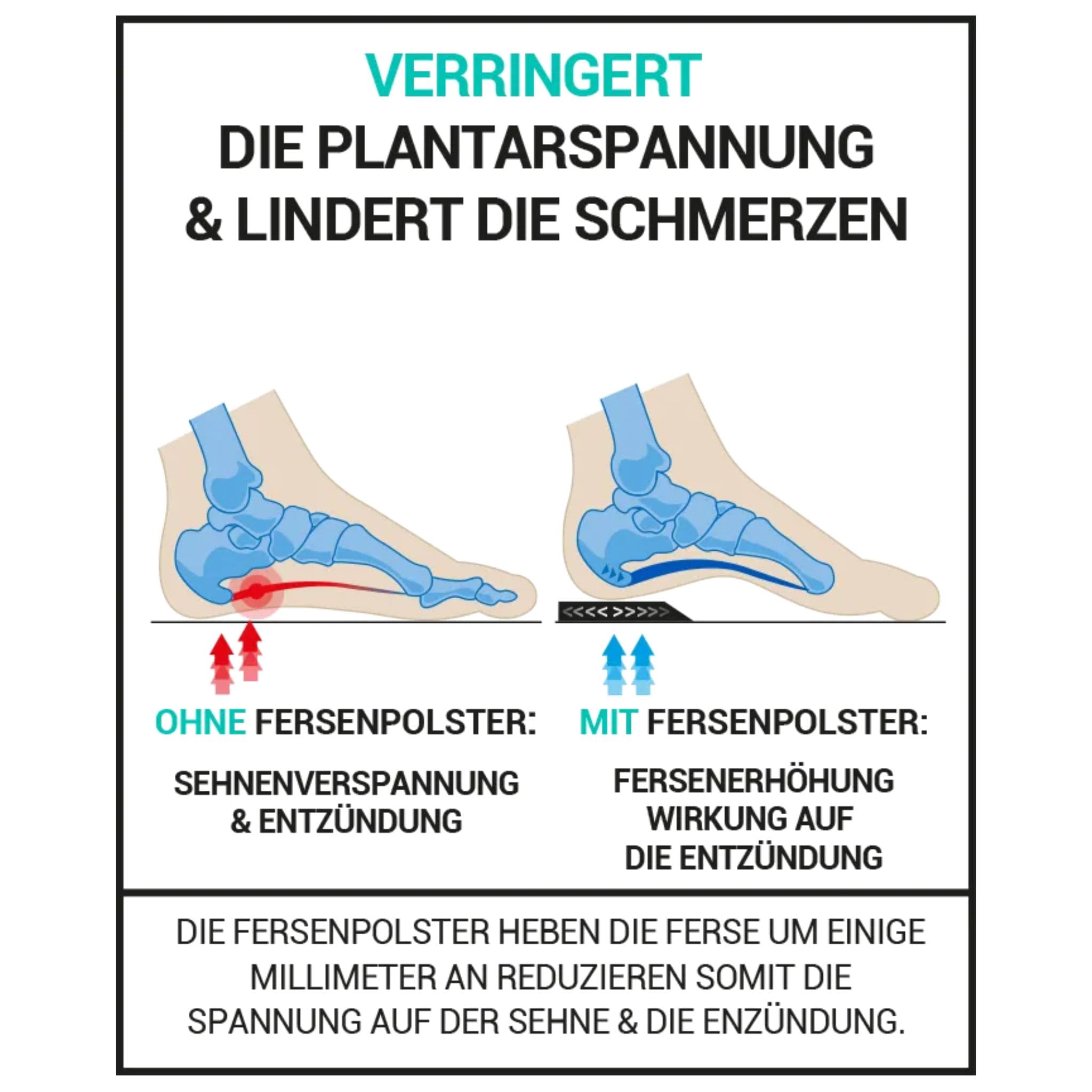 Darstellung der Funktionsweise