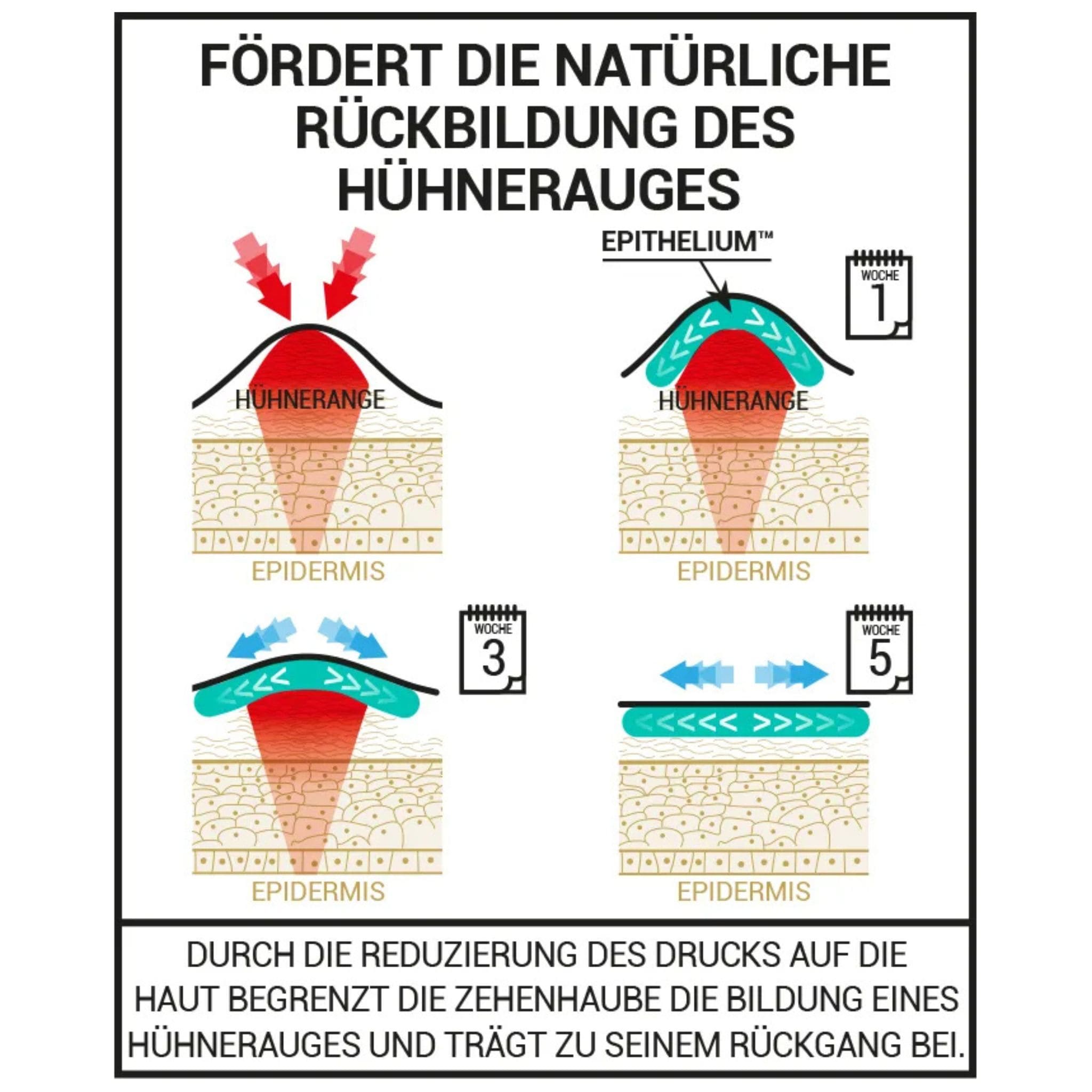 Gel Zehenschutz bei Hühneraugen