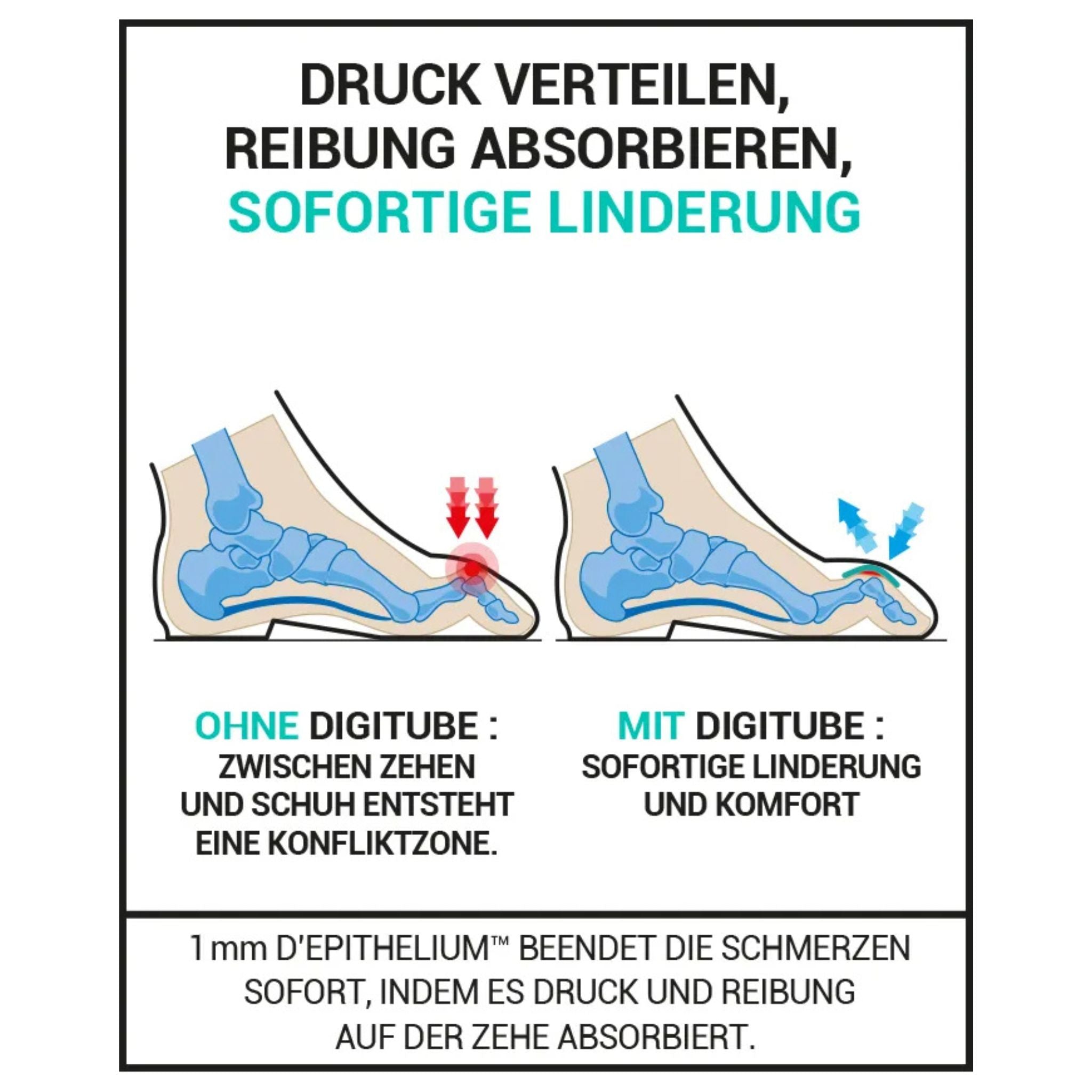 Hühneraugen am Zeh Gelschlauch