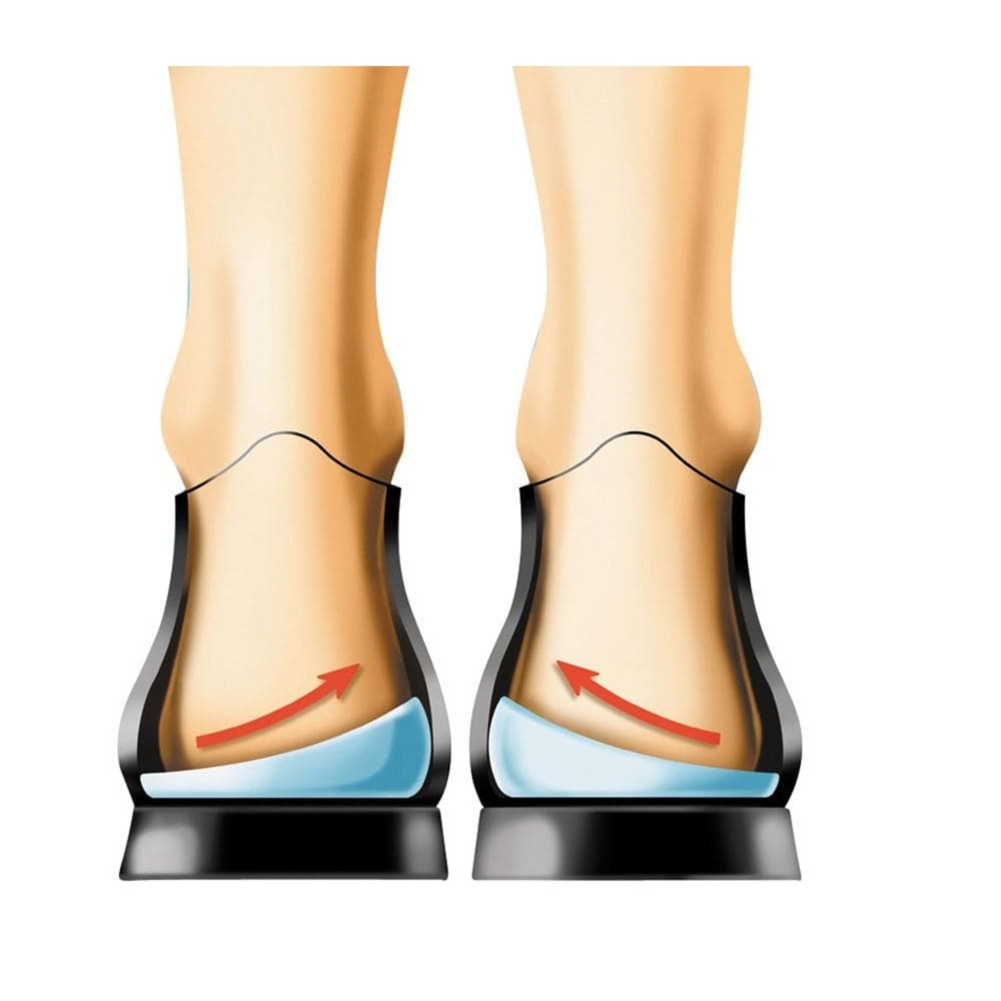 Korrektur von X-Beinen